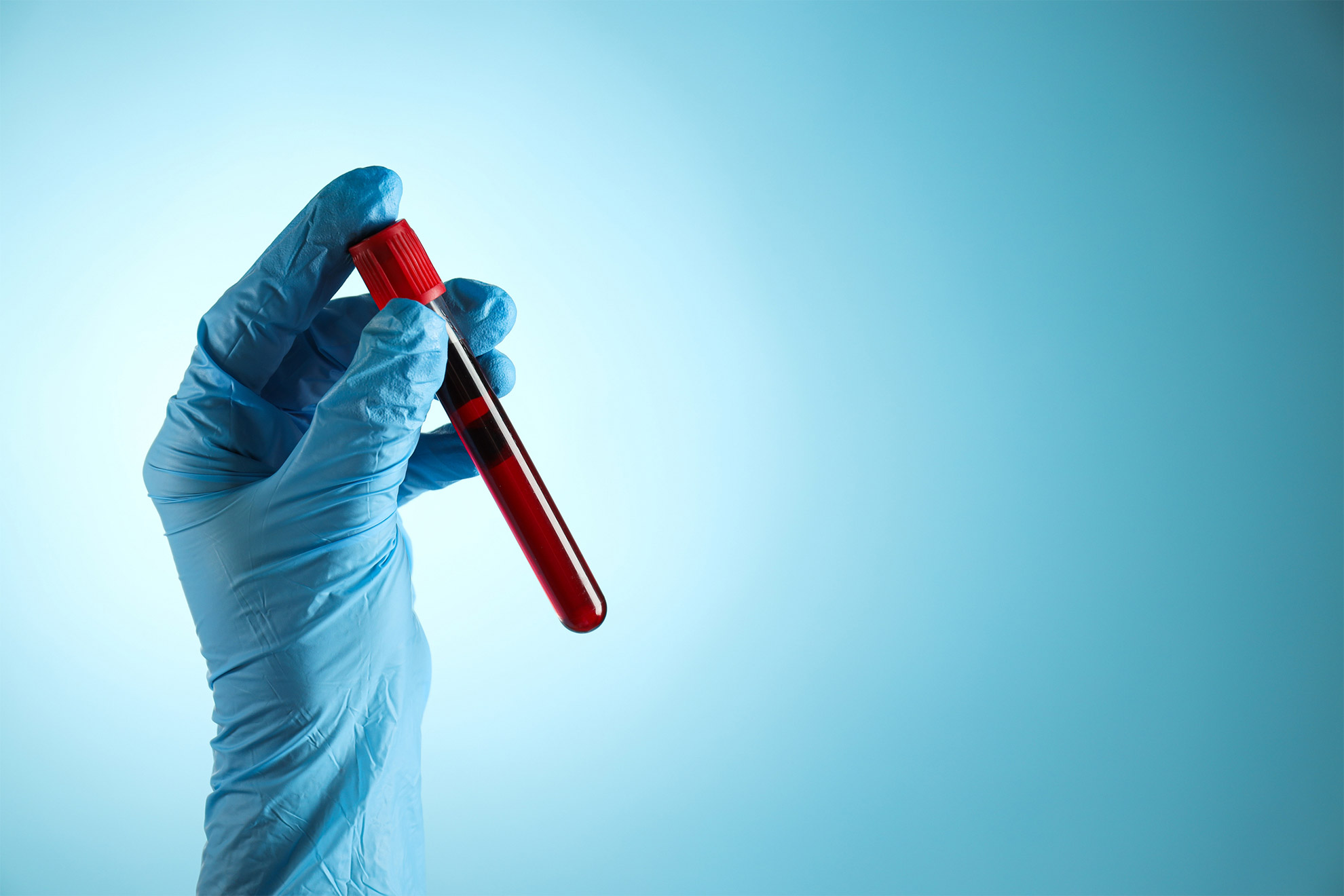 Blood test has potential to detect earliest signals of Alzheimer’s disease